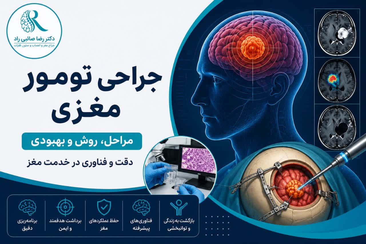 جراحی تومور مغزی چگونه انجام می‌شود؟ روش‌های عمل، عوارض و بهبودی