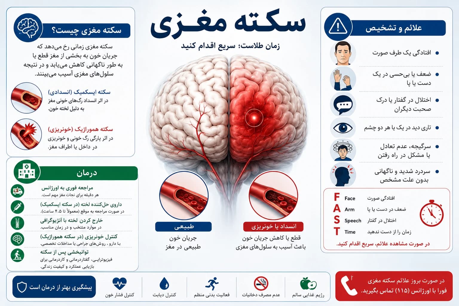 سکته مغزی ایسکمیک و خونریزی مغزی در تصویربرداری MRI و CT