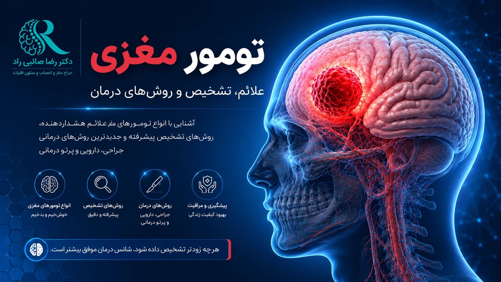 تصویر شماتیک تومور مغزی در نیمکره مغز انسان همراه با نمایش محل تومور و ساختار مغز
