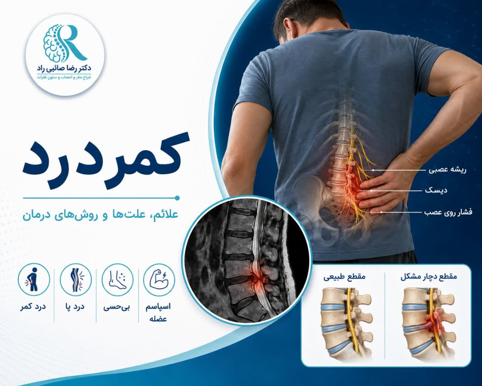 کمر درد چیست؟ علت، علائم و بهترین روش‌های درمان
