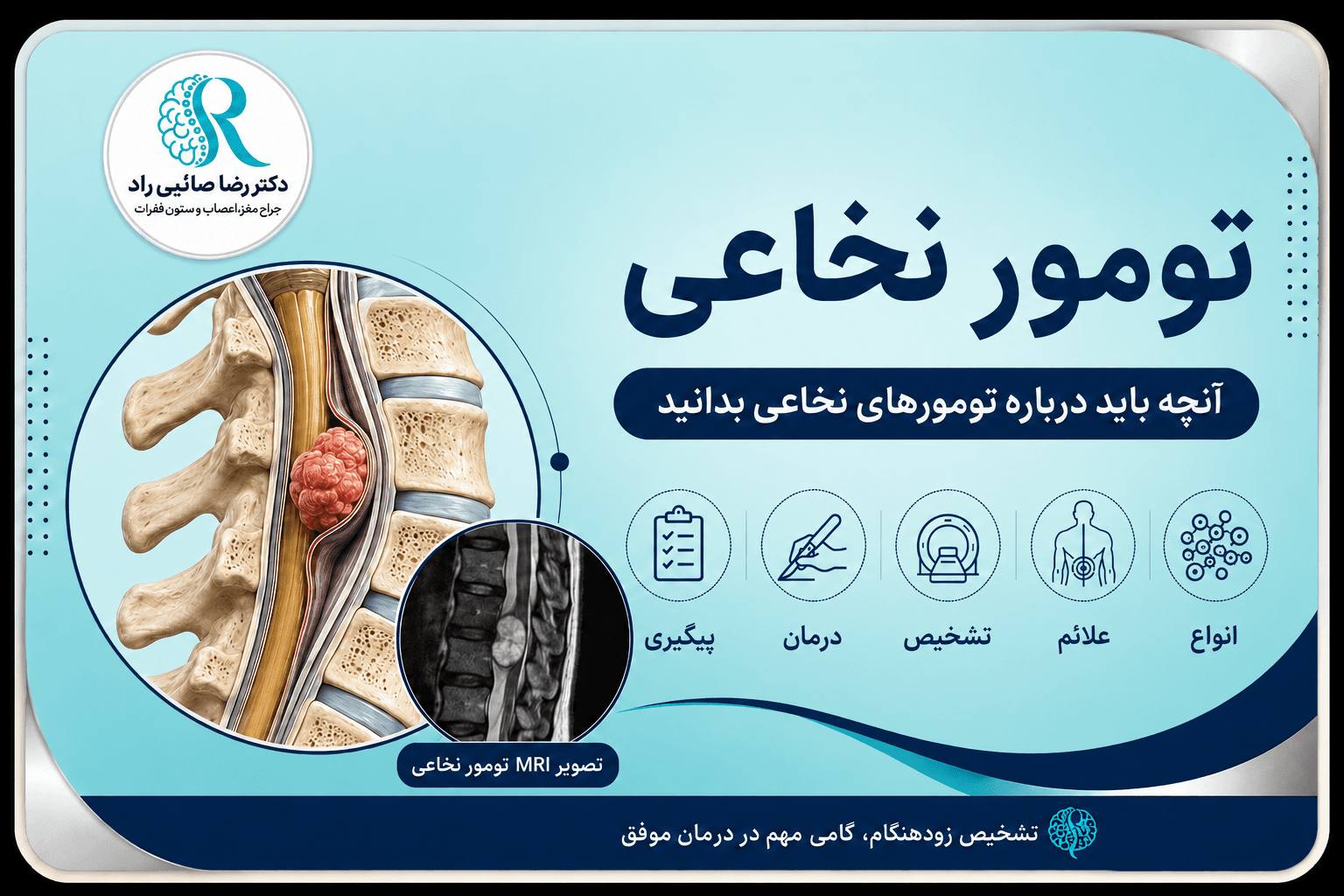 تومور نخاع چیست؟ بررسی علائم، انواع، تشخیص و روش‌های درمان