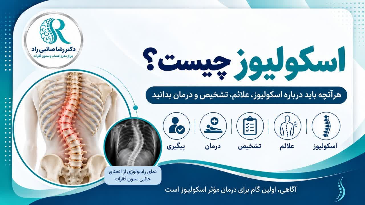 اینفوگرافی به زبان فارسی با موضوع اسکولیوز یا انحراف ستون فقرات و تغییر شکل مهره های کمر و پشت