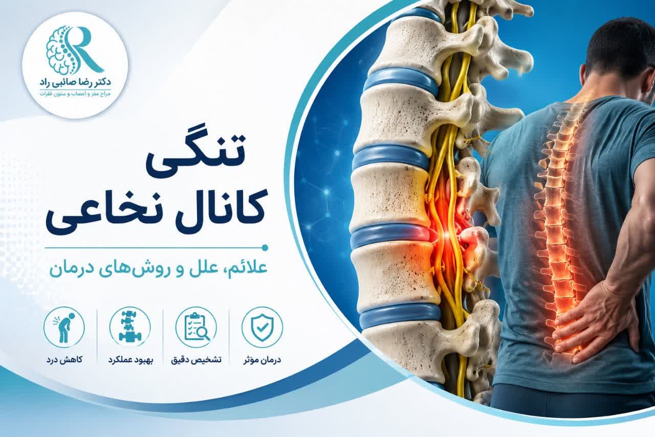 تنگی کانال نخاعی(Spinal Stenosis)؛ هر آنچه باید درباره علائم، تشخیص و درمان بدانید