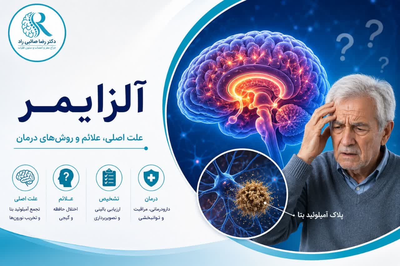 بیماری آلزایمر؛ علائم هشداردهنده، تشخیص زودهنگام و درمانهای جدید