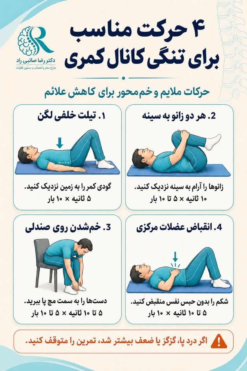 حرکات اصلاحی برای تنگی کانال نخاعی مرکزی؛ ۴ تمرین ساده برای کاهش علائم