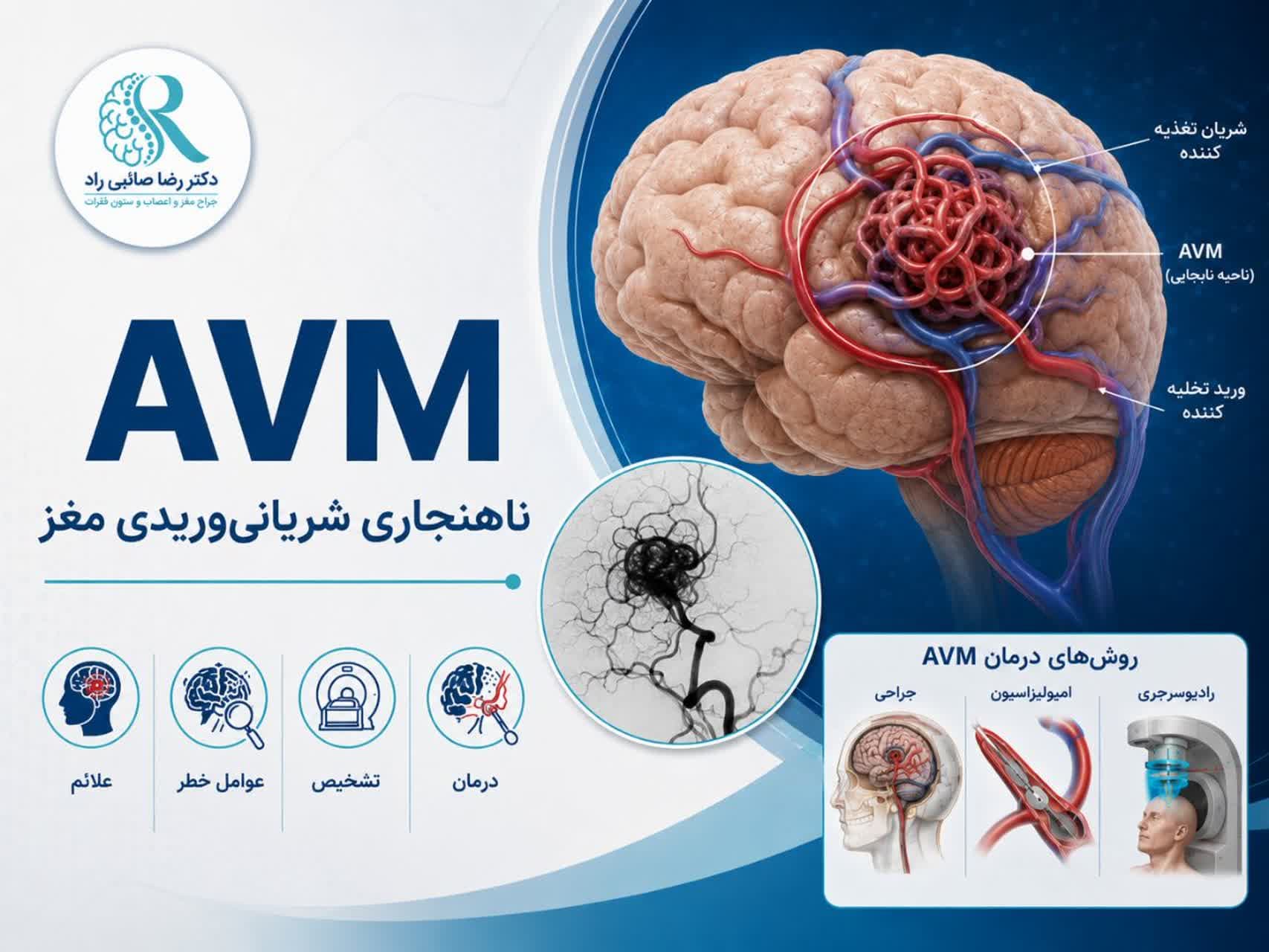 ناهنجاری شریانیوریدی مغز (AVM) چیست؟ علائم، خطر خونریزی، تشخیص و درمان