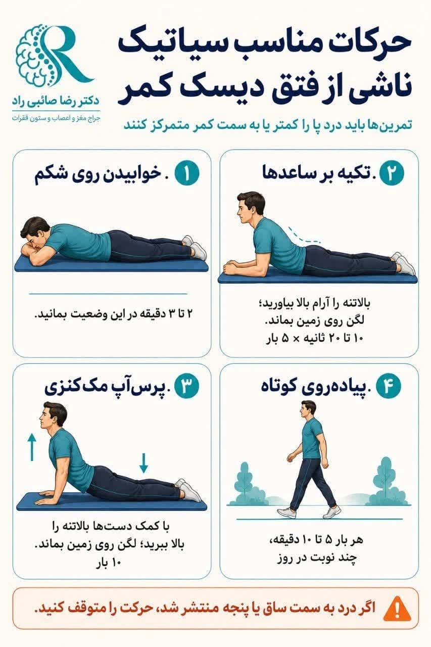 حرکات اصلاحی برای سیاتیک و فتق دیسک کمر؛ تمرینات مناسب و نکات مهم