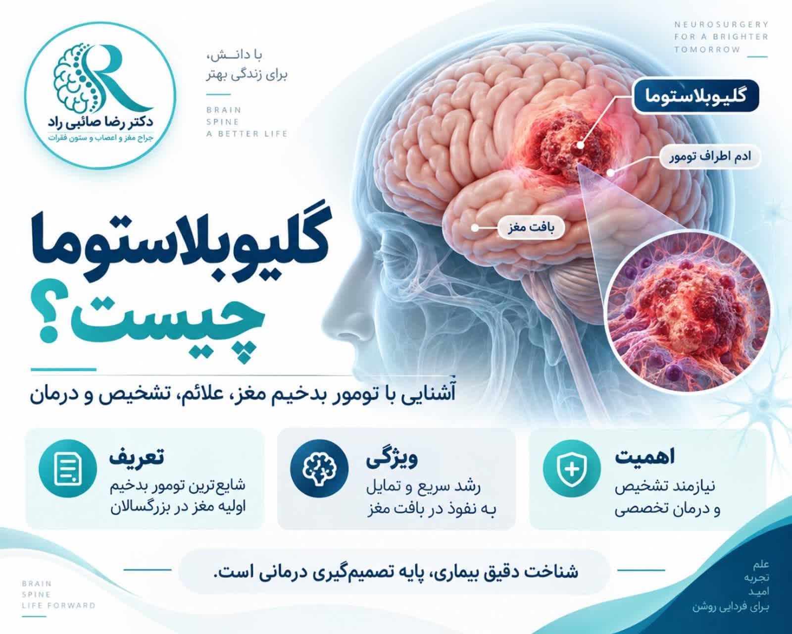 اینفوگرافی به زبان فارسی گلیوبلاستوما یا GBM، تومور بدخیم مغز و محل رشد آن در بافت مغزی
