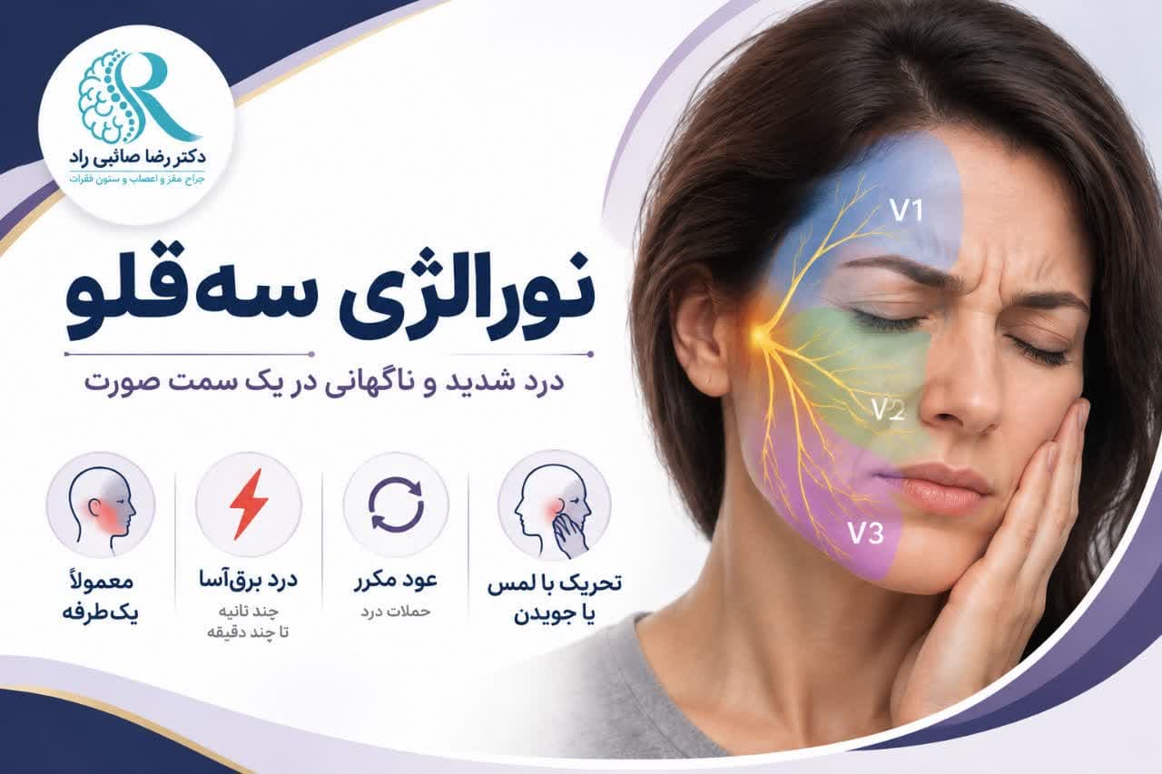 نورالژی عصب سهقلو چیست؟ علائم، علتها، تشخیص و درمان درد عصب صورت