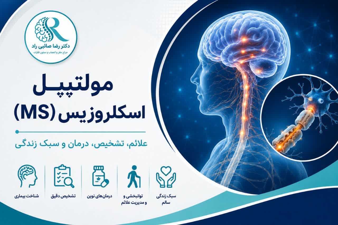 بیماری اماس(MS)چیست؟ علائم، علتها، تشخیص و روشهای درمان