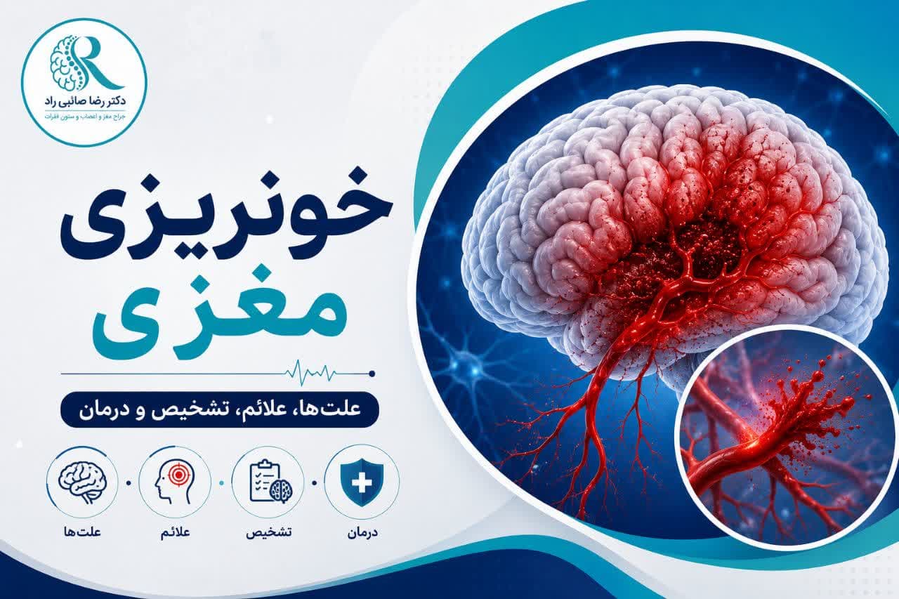 خونریزی مغزی؛ انواع، علائم هشداردهنده، علتها و روشهای درمان